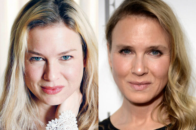 Renée Zellweger Before and after