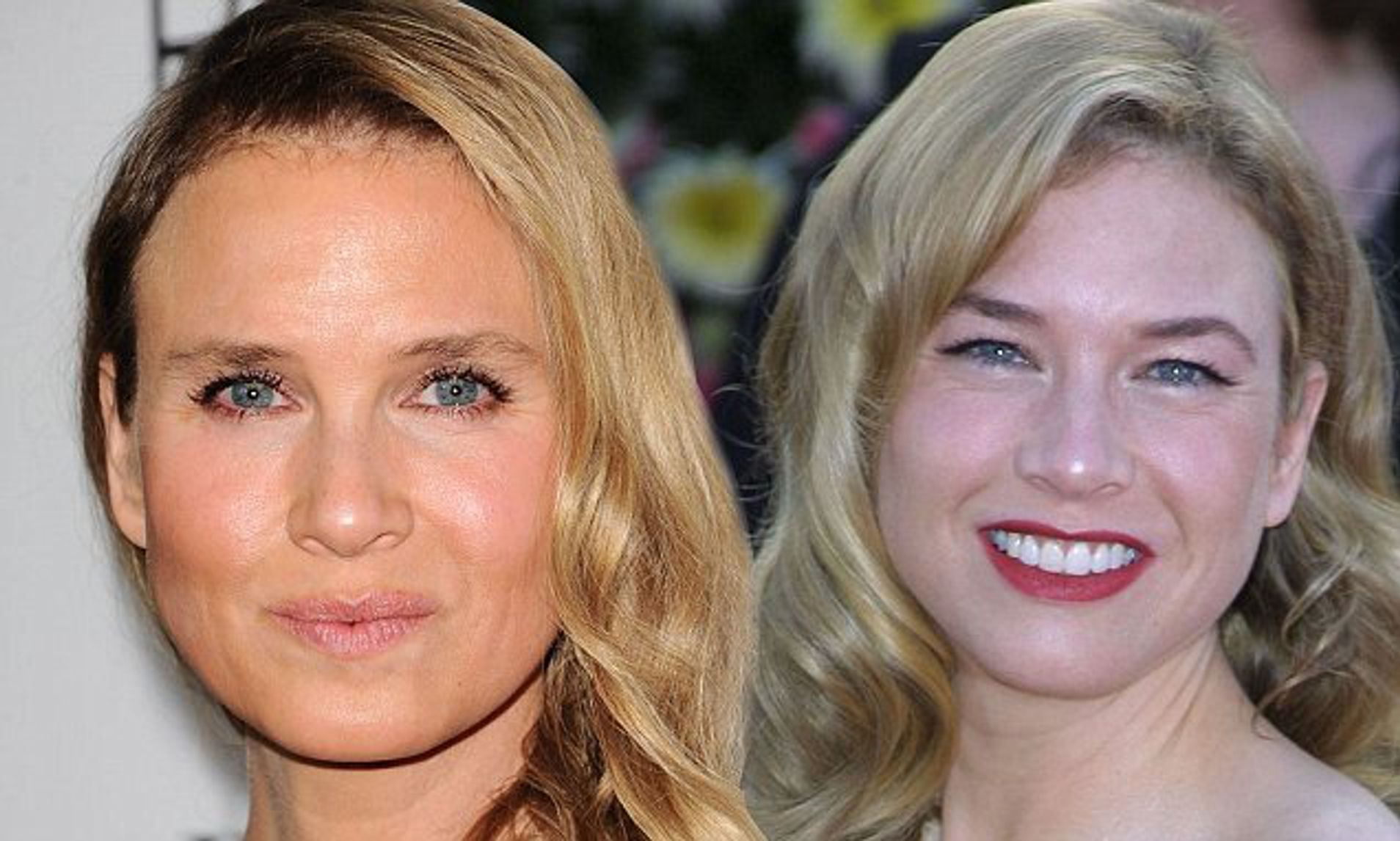 Renee Zellweger before and after face plastic surgery