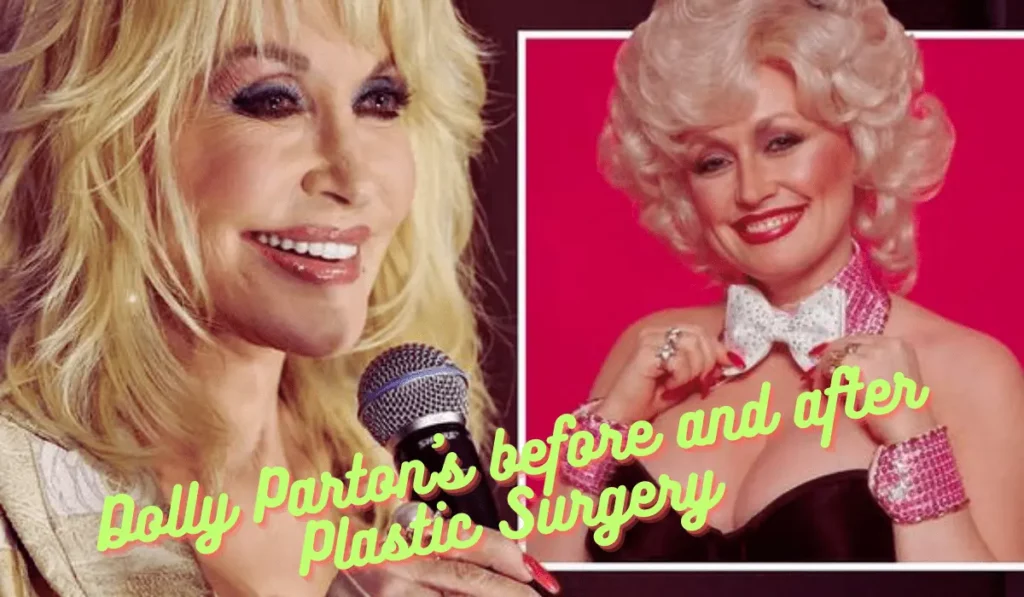 Dolly Parton’s before and after Plastic Surgery differences