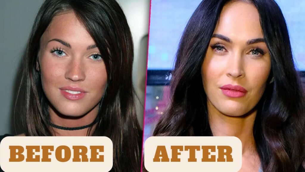 Megan Fox before and after Plastic Surgery