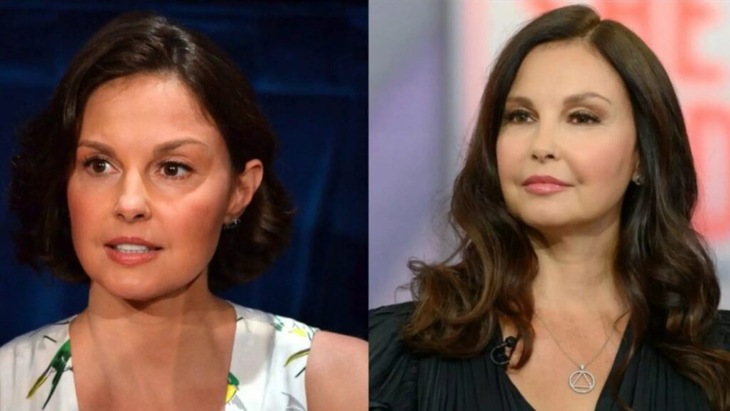 Ashley Judd nose job