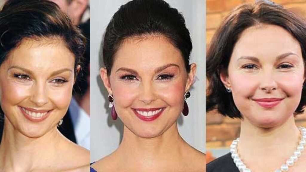 Ashley Judd Botox